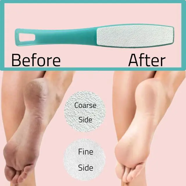Alt view image 3 of 7 - 1 ALAZCO Double Sided Foot File Pumice Ergonomic Handle Scrubber Immediate Result Smooth Feet Heel Scraper Exfoliate Buffer Dead Skin Callus Corn Emery Fine & Coarse Pedicure Tool