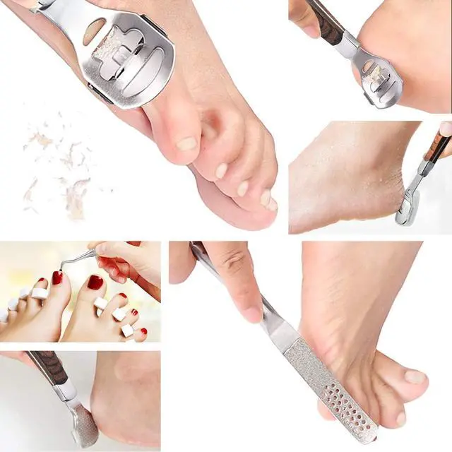 Alt view image 6 of 7 - 15 Pcs Callus Shaver, Foot Shaver Callus Remover for Feet Hand Care | Stainless Steel Shaver and Wooden Handle, With Foot File, 10 Pcs Blades, Foot File Head and Dead Skin Storage Cover