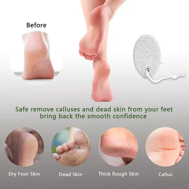 Alt view image 4 of 7 - Natural Foot Pumice Stone for Feet, Borogo 2-Pack Lava Pedicure Tools Hard Skin Callus Remover for Feet and Hands - White