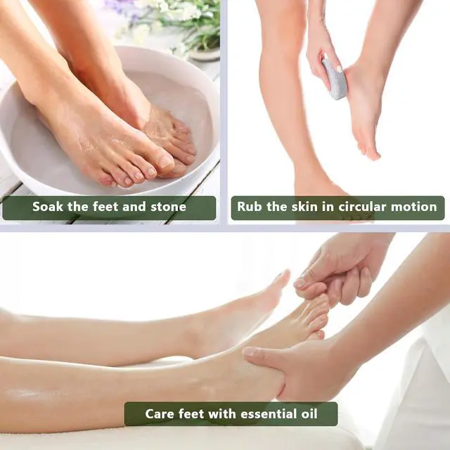 Alt view image 5 of 7 - Natural Foot Pumice Stone for Feet, Borogo 2-Pack Lava Pedicure Tools Hard Skin Callus Remover for Feet and Hands - White