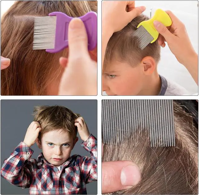 Alt view image 5 of 7 - Maitys 8 Pcs Lice Combs Kids Pet, 3.5 x 2 Inch, 3.54 x 1.57 Inch, Classic | Double Sided for Head Lice Removal, Flea Comb with Plastic Metal Fine Tooth Design, Nit Dandruff Grooming Tool