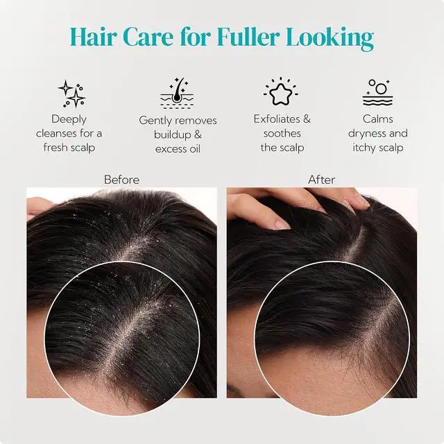 Alt view image 7 of 7 - HEETA 2-Pack Large Scalp Massager Scrubber Shampoo Brush for Hair Growth | Soft Silicone Head Massager, Shampoo Brush Cleansing Exfoliating for All Hair Type, Easy-Grip, Hair Care Shower Accessories