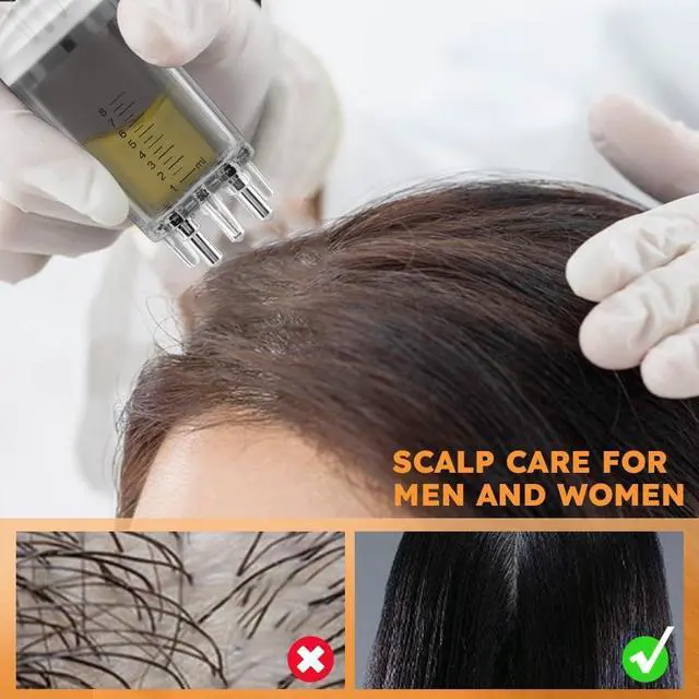 Alt view image 5 of 7 - 2 PCS Scalp Applicator Comb for Hair Growth, Hair Oil Applicator Scalp Massager Ball Root Comb Applicator Bottle Brush Tool, Easy-to-Use Hair Oil Dispenser for Hair Care Oils Nutrients