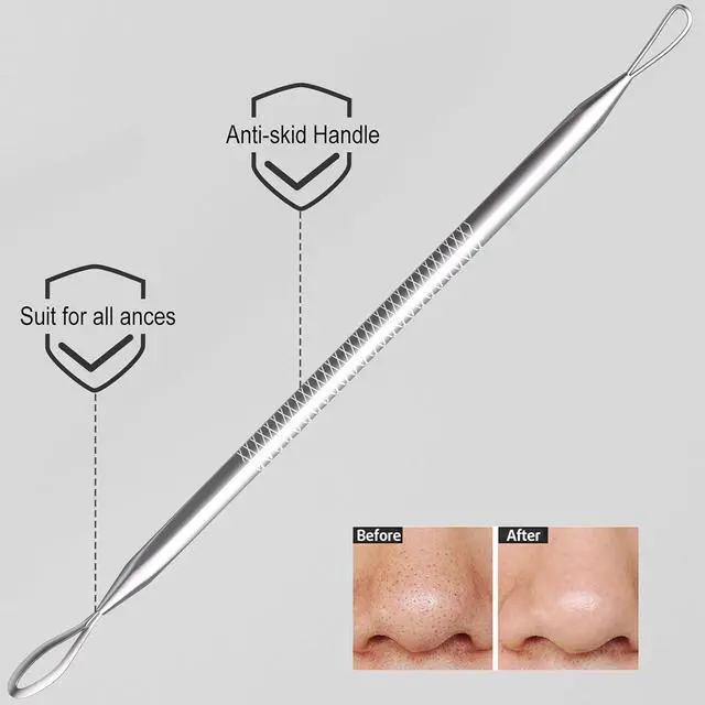 Alt view image 4 of 7 - Cbiumpro 6Pack Blackhead Remover Tools, Surgical Steel Comedone Extractor Kit for Acne Whitehead and Zit Removal with Storage Case