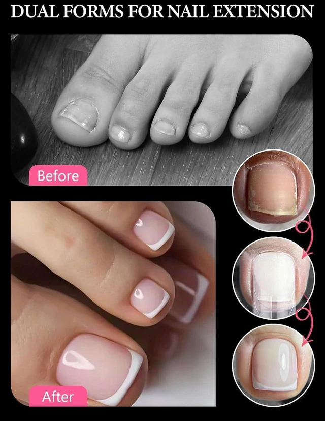 Alt view image 6 of 6 - EBANKU Poly Gel Toenail Kit with Dual Reusable Nail Forms