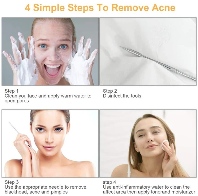 Alt view image 2 of 7 - 9 PCS Blackhead Remover Tools, Pimple Popper & Extractor
