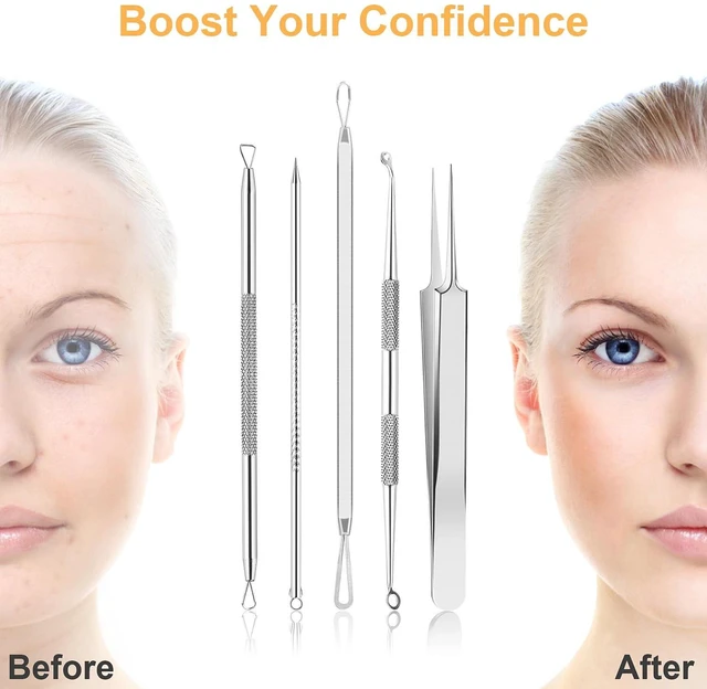 Alt view image 4 of 7 - 9 PCS Blackhead Remover Tools, Pimple Popper & Extractor