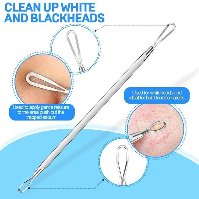 Alt view image 4 of 6 - Teenitor 2-in-1 Pimple Extractor Surgical Grade Blackhead Comedone Removal Tool for Face Nose Silver