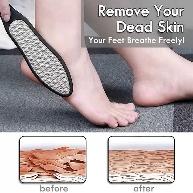 Alt view image 5 of 5 - 3-in-1 Large Size Foot File Callus Remover, Double Sided Stainless Steel Heel Scraper for Cracked Heels, Pedicure Tool with Coarse and Fine Sides, 1 Pc