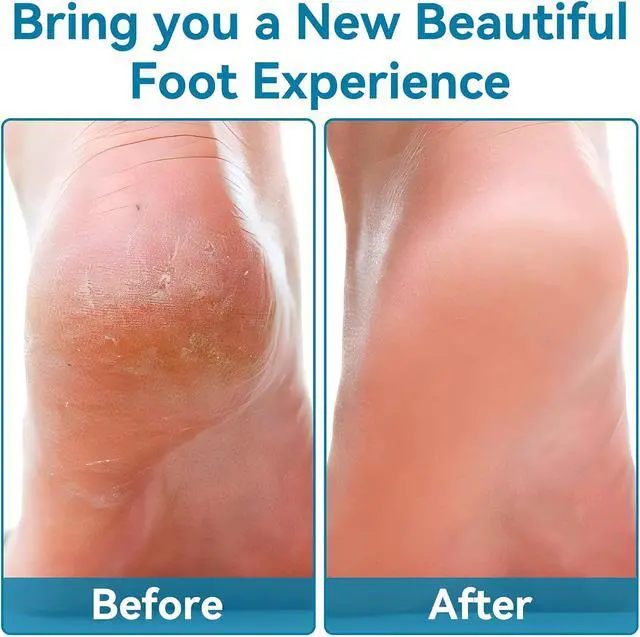 Alt view image 6 of 7 - Glass Foot File, Crystal Glass Callus Remover Foot Scrubber and Heel Scraper for Men, Women, Dead Skin Removal Pedicure Tool, Blue