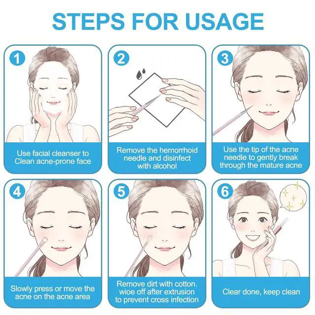 Alt view image 7 of 7 - Professional Stainless Pimple Popper Tool Kit - 5 Piece Blackhead Remover Set with Tweezers for Face, Risk Free Treatment Pimple Extractor