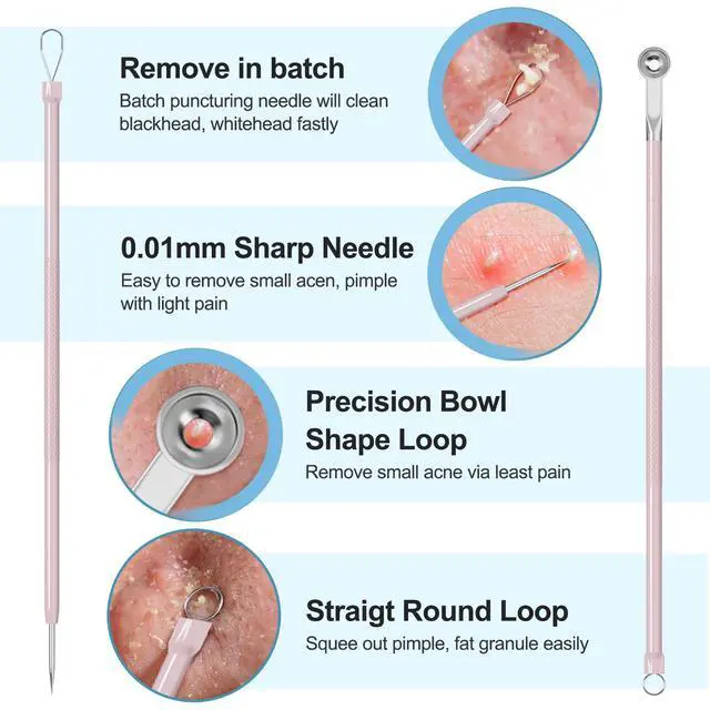 Alt view image 2 of 7 - Professional Stainless Pimple Popper Tool Kit - 5 Piece Blackhead Remover Set with Tweezers for Face, Risk Free Treatment Pimple Extractor