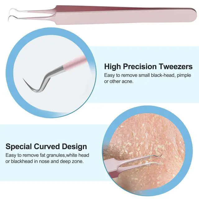 Alt view image 6 of 7 - Professional Stainless Pimple Popper Tool Kit - 5 Piece Blackhead Remover Set with Tweezers for Face, Risk Free Treatment Pimple Extractor