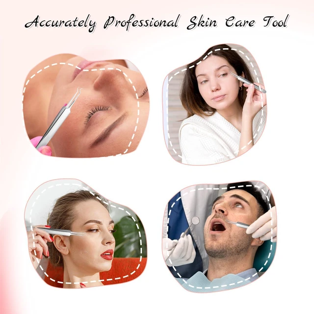 Alt view image 6 of 7 - 3 Pieces Stainless Steel Pimple Extractor Blackhead Tweezers Needle Nose Tweezers Pimple Popper Curved Tweezers Pimples Tweezer Extractor Tool Pore Tweezer for Skin White