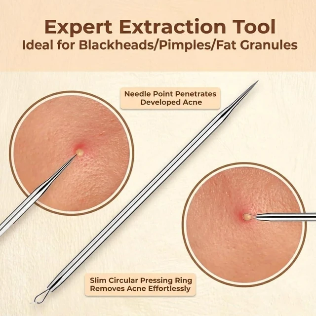 Alt view image 4 of 7 - 2 Pcs Pimple Popper Tool, Blackhead Remover, Comedone Extractor for Acne