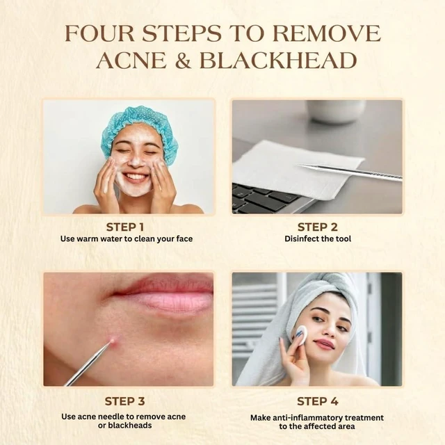 Alt view image 3 of 7 - 2 Pcs Pimple Popper Tool, Blackhead Remover, Comedone Extractor for Acne