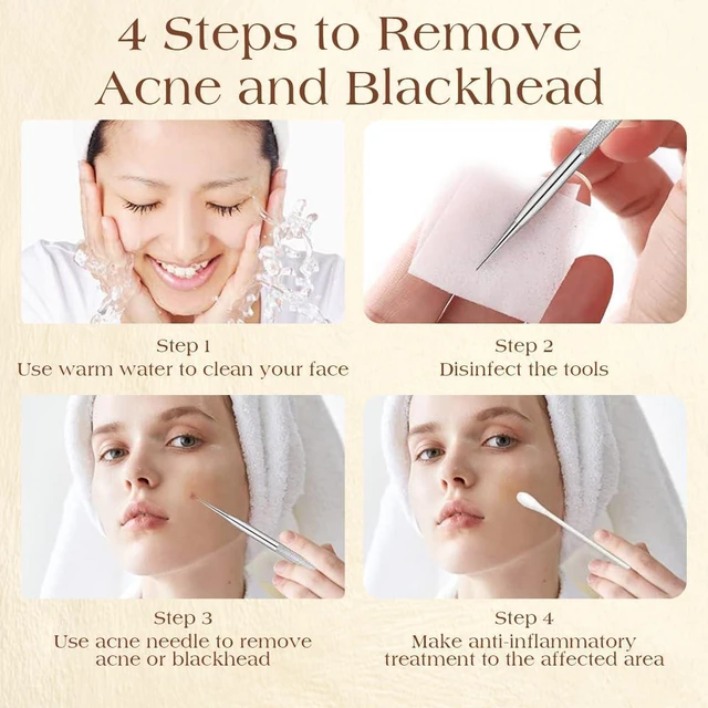 Alt view image 6 of 7 - 2 Pcs Pimple Popper Tool, Blackhead Remover, Comedone Extractor for Acne