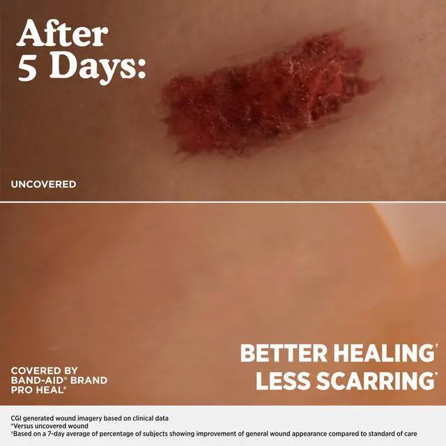 Alt view image 2 of 6 - BAND-AID Pro Heal 5 Day Protect Hydrocolloid Blister Bandages, 6 Ct