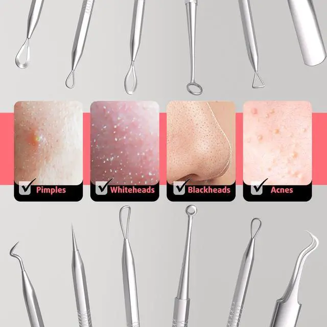 Alt view image 3 of 6 - Cbiumpro 6 Pack Blackhead Remover Tools, Pimple Popper Tool Kit
