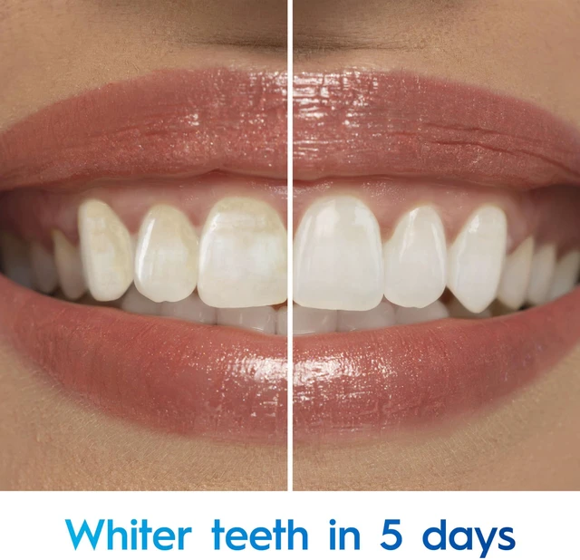Alt view image 3 of 7 - Crest 3D White Advanced Teeth Whitening Toothpaste, Radiant Mint, 3.3oz, Pack of 2