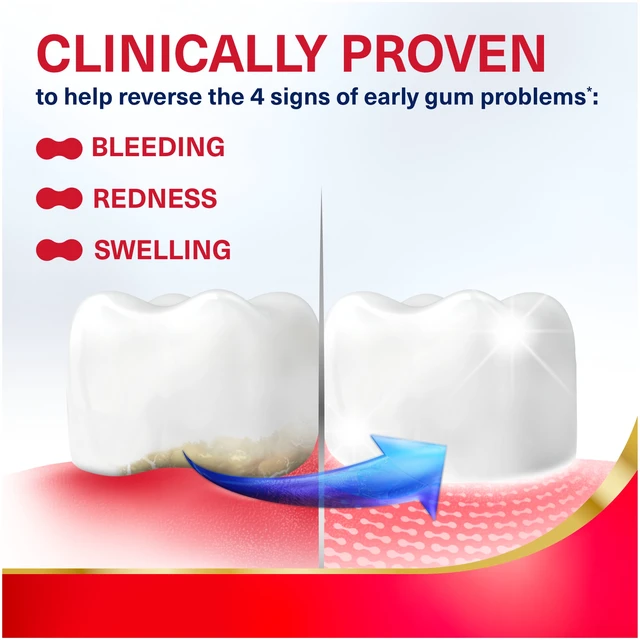Alt view image 3 of 5 - Parodontax Active Gum Repair Whitening Toothpaste Mint Flavor 3.4Oz