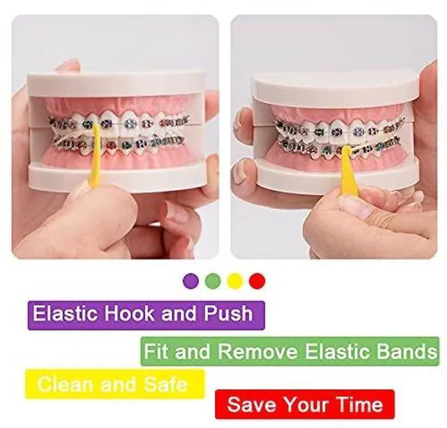Alt view image 5 of 6 - 20 Pack Braces Rubber Band Tool Dental Elastic Rubber Bands Placers for Braces Disposable Plastic Orthodontic Elastic Placers