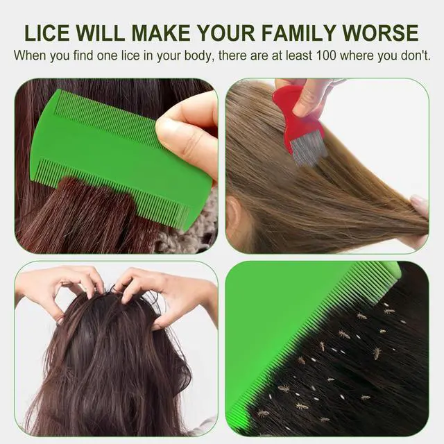 Alt view image 5 of 5 - 4 Pcs Head Hair Comb, 2 Pieces Lice Combs Double Sided2 Pieces Removal Dandruff Comb with Metal Teeth. Professional Anti-Dandruff, No Damage to Hair