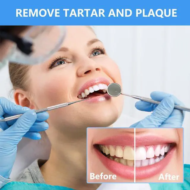 Alt view image 2 of 6 - Professional Plaque Remover Dental Tool Kit - Stainless Steel Pick, Tartar Scraper, Tooth Cleaner, Oral Care Hygiene Set for Dentist, Personal, and Pets with Storage Box