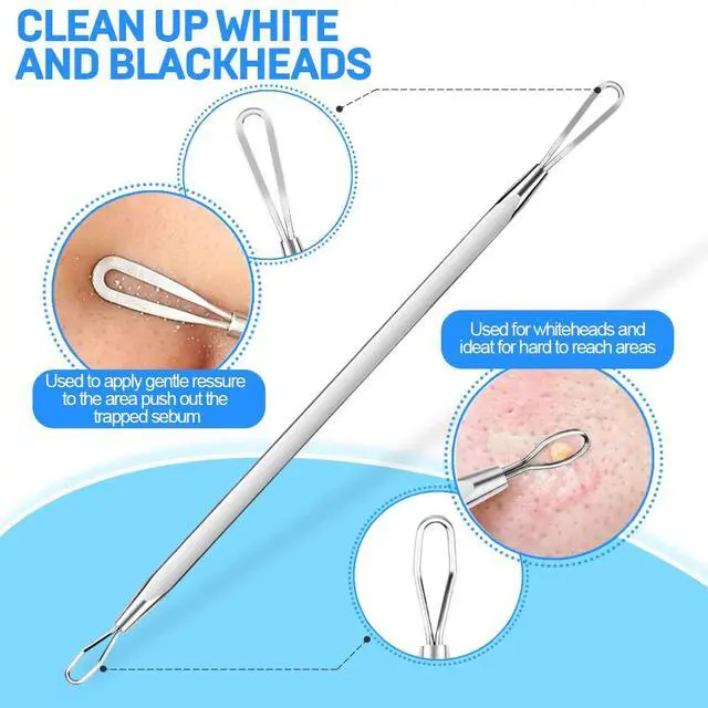 Alt view image 5 of 6 - Teenitor 2-in-1 Surgical Grade Pimple Extractor Blackhead Comedone Removal Tool for Face Nose Silver