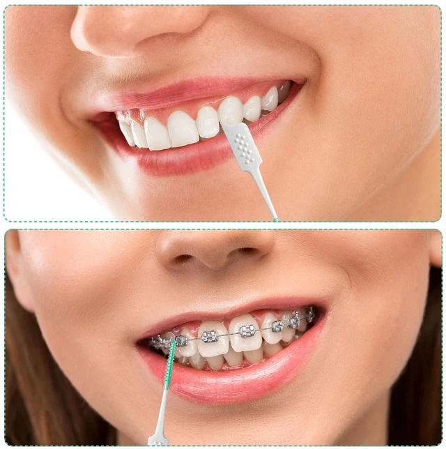 Alt view image 7 of 7 - Soft Silicone Interdental Brush and Dental Floss Picks, Braces Brush, Disposable, 160pcs (Green)