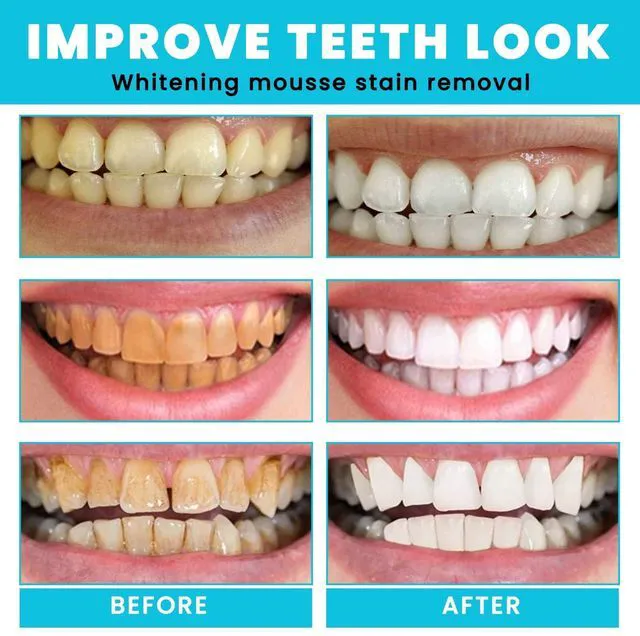 Alt view image 4 of 7 - Teeth Whitening Mousse - Refreshing Breath Deep Cleaning Foam Toothpaste Natural Mouth Wash Water, Ultra Fine Mousse Foam To Reduce Stains