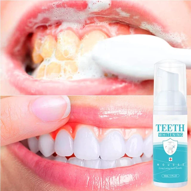 Alt view image 2 of 7 - Teeth Whitening Mousse - Refreshing Breath Deep Cleaning Foam Toothpaste Natural Mouth Wash Water, Ultra Fine Mousse Foam To Reduce Stains