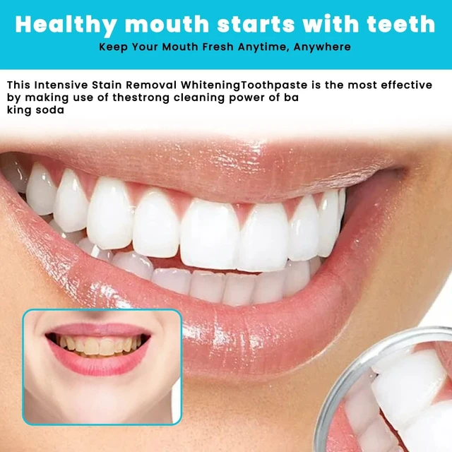 Alt view image 7 of 7 - Teeth Whitening Mousse - Refreshing Breath Deep Cleaning Foam Toothpaste Natural Mouth Wash Water, Ultra Fine Mousse Foam To Reduce Stains