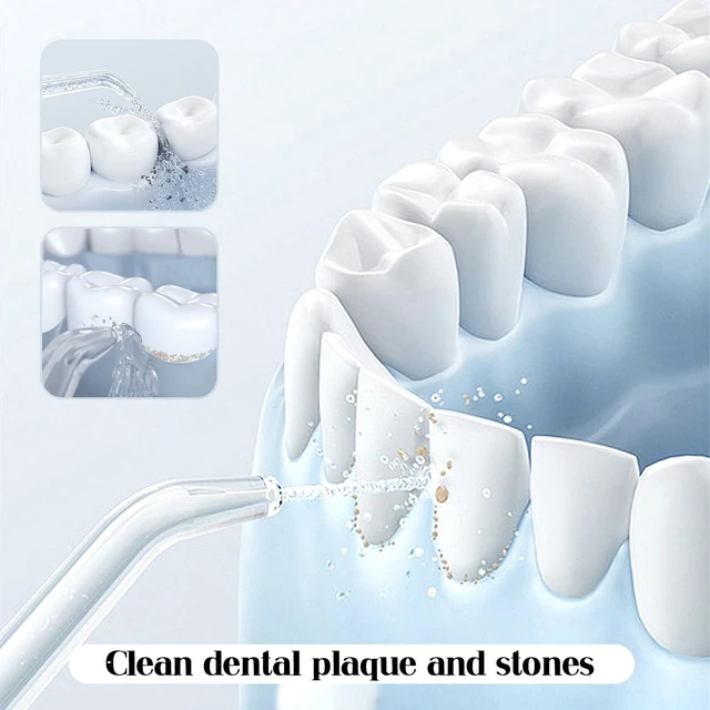 Alt view image 2 of 7 - 2 PCS Replacement Classic Jet Tips, Water Flosser Replacement Head | Replacement Tip Accessories, Compatible with Waterpik Water Flossers, 2 Colors