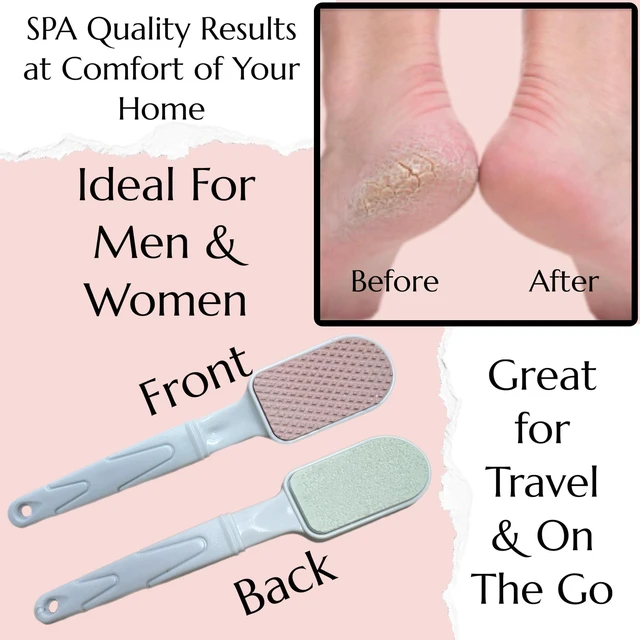 Alt view image 3 of 7 - Double-Sided Pumice Stone & Foot File Rasp Heels Scraper Scrubber Cracked Feet Instant Exfoliator Buffer Dead Hard Skin Callus Remover Elbows Hand Feet Pedicure Tool Corn Softener Sole Smoother