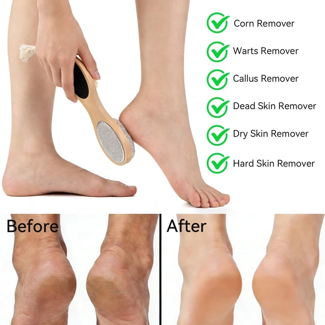 Alt view image 6 of 7 - 4 in 1 Foot File Callus Remover with Pumice Stone Feet Scrubber Dead Skin Foot Rasp Dense Foots Brush for Shower,Foot Pumice Tools Kit with Cuticle File,Foot Care Tools for Man Woman Home
