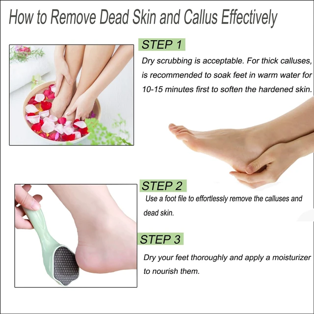 Alt view image 5 of 7 - Hard Skin Remover Nano Glass Foot File - Foot Callus Remover with Handle Foot File Callus Remover with Nano-Level Grinding Points Durable Foot Scrubber Dead Skin Removal for Wet Dry Feet (Green)
