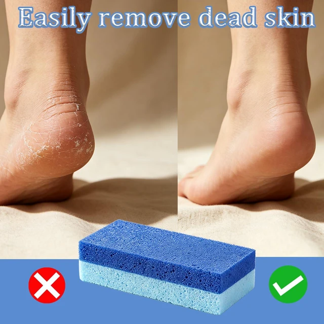 Alt view image 3 of 7 - 6 Pack Foot Pumice Stone, Double Sided Callus Remover for Feet | Exfoliating Scrubber Tool for Dead Skin Removal, Cracked Heels and Rough Dry Feet, Pedicure Essentials Set