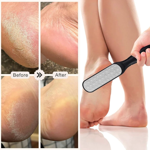 Alt view image 5 of 6 - Foot File,Double Sided Multidirectional Nickel Foot File Callus Remover - Immediately Reduces calluses and Corns to Powder forInstant Results, Safe Tool