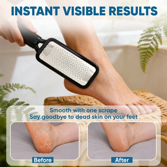 Alt view image 6 of 6 - Foot File Callus Remover, Large Stainless Steel Foot Rasp, Heavy Duty Foot Scraper for Dead Skin and Hard Heels, Waterproof Pedicure Tools for At Home Foot Care