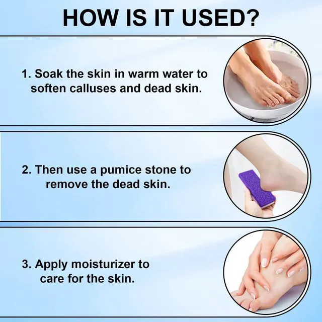 Alt view image 5 of 7 - Foot Pumice Stone 2 Pack Pedicure Stone for Feet (Purple) | for Feet Callus Remover and Scrubber Double Sided Pedicure Foot Pumice Stone for Feet and Heels Callus and Dead Skins