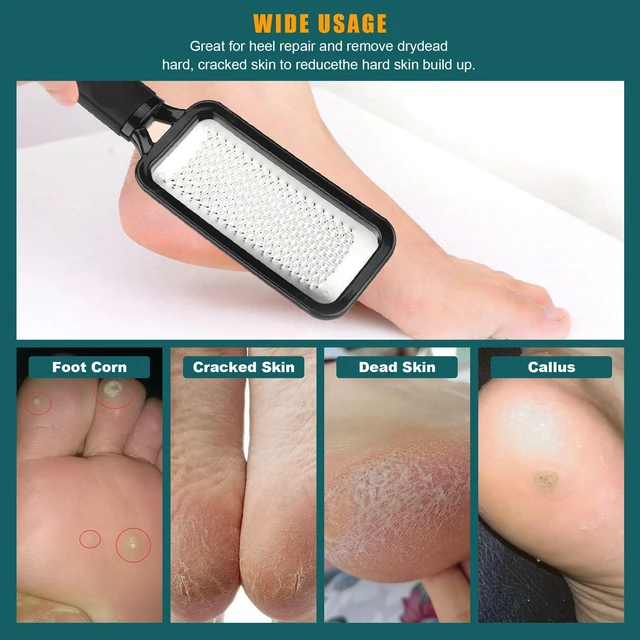 Alt view image 7 of 7 - Foot Files Foot Scrubber Pedicure, Stainless Steel Callus Remover for Feet, Professional Foot Grater Rasp Scraper to Hard Skin Corns for Dry and Wet Fee