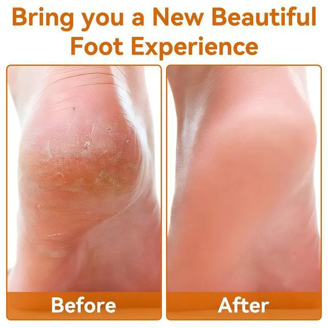 Alt view image 6 of 7 - Glass Foot File, Crystal Glass Callus Remover Foot Scrubber and Heel Scraper for Men, Women, Dead Skin Removal Pedicure Tool, Gold