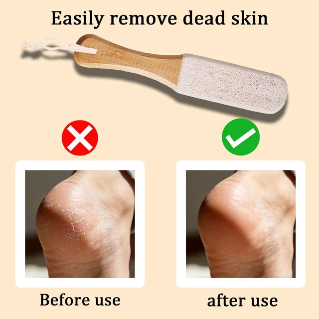 Alt view image 5 of 6 - 2-Pack Professional Pedicure Foot File & Pumice Stone with Wooden Handle | Callus Remover for Dead Skin, Dry Rough Feet, Cracked Heels & Corns Essential Foot Scrubber for Home or Salon Use