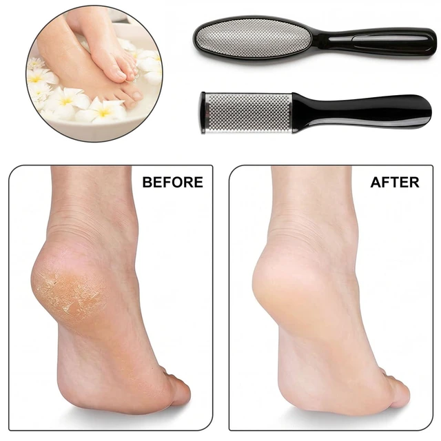 Alt view image 4 of 4 - 10 in 1 Pedicure Kit, Professional Pedicure Tools,Foot Rasp Foot File,Professional Foot Care Tools for Pedicure to Removes Hard Skin Corns