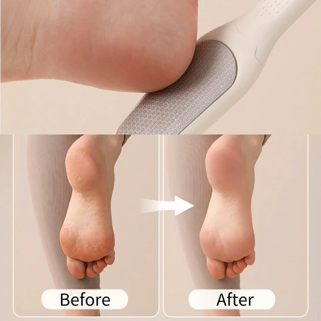 Alt view image 6 of 7 - Detachable Foot File, 2-in-1 Double Sided Callus Remover Tool | Stainless Steel Plate, Coarse & Fine Dual Surface, Non-Slip Grip Handle, Portable Tool for Dead Skin & Cracked Heel Foot Care