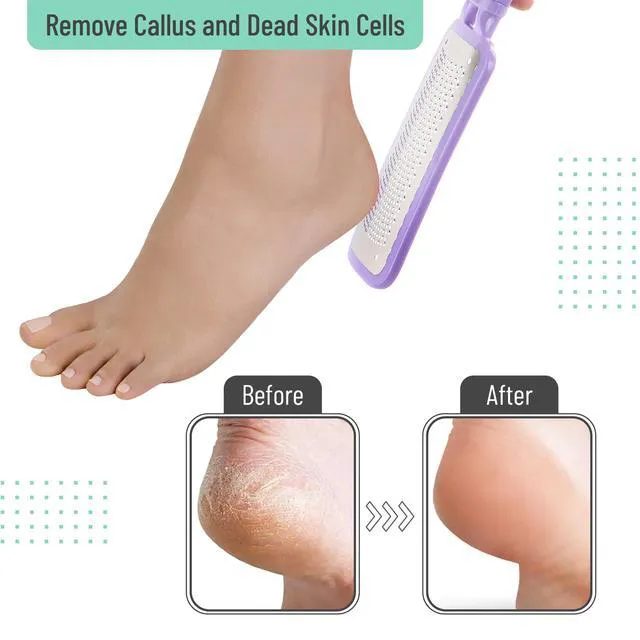 Alt view image 3 of 7 - Foot File Callus Remover - Purple Foot Scraper & Rasp for Dead Skin, Heel Scrubber