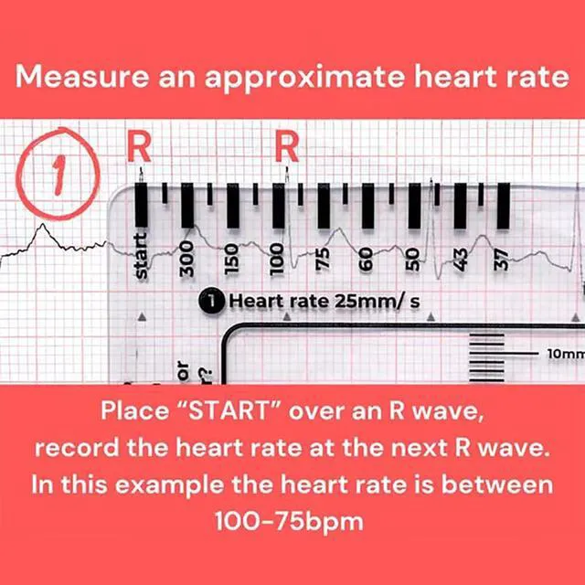 Alt view image 2 of 7 - 1Pc ECG 7 Step Ruler for ECG/EKG Interpretation, EKG Ruler Plastic Measuring Tool, Transparent Calipers Measuring Tool Follow a 7 Plan