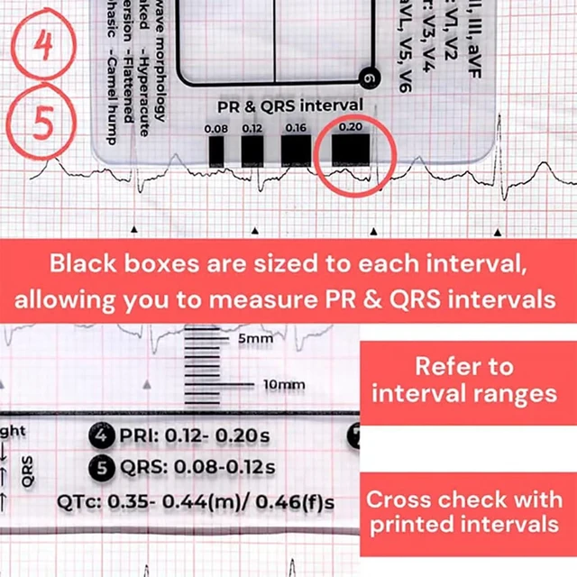 Alt view image 5 of 7 - 1Pc ECG 7 Step Ruler for ECG/EKG Interpretation, EKG Ruler Plastic Measuring Tool, Transparent Calipers Measuring Tool Follow a 7 Plan