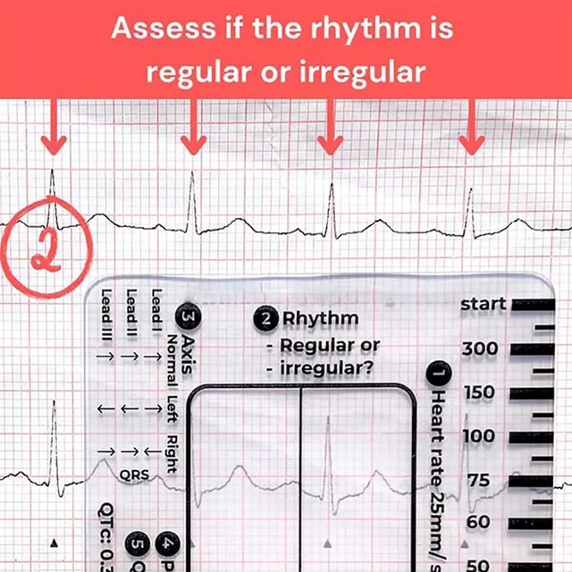 Alt view image 3 of 7 - 1Pc ECG 7 Step Ruler for ECG/EKG Interpretation, EKG Ruler Plastic Measuring Tool, Transparent Calipers Measuring Tool Follow a 7 Plan